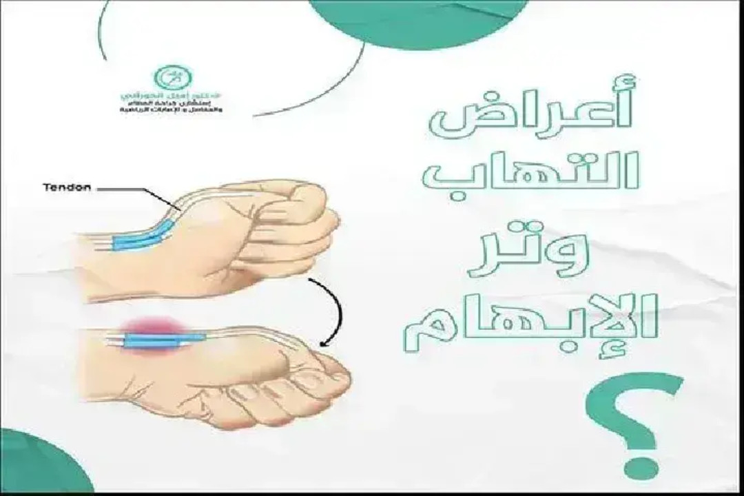 Al Tamayuz Physiotherapy Center-featured-0